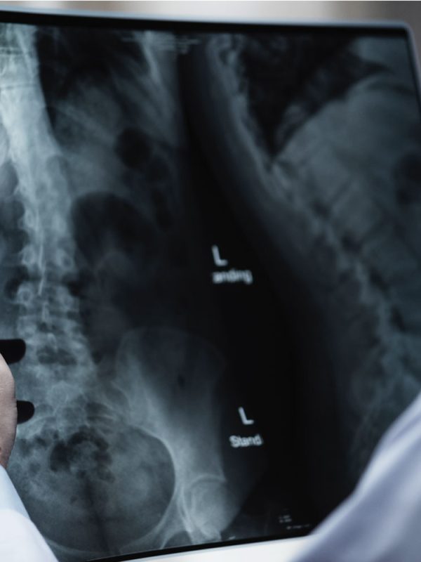 Making Sure the Closing Happens