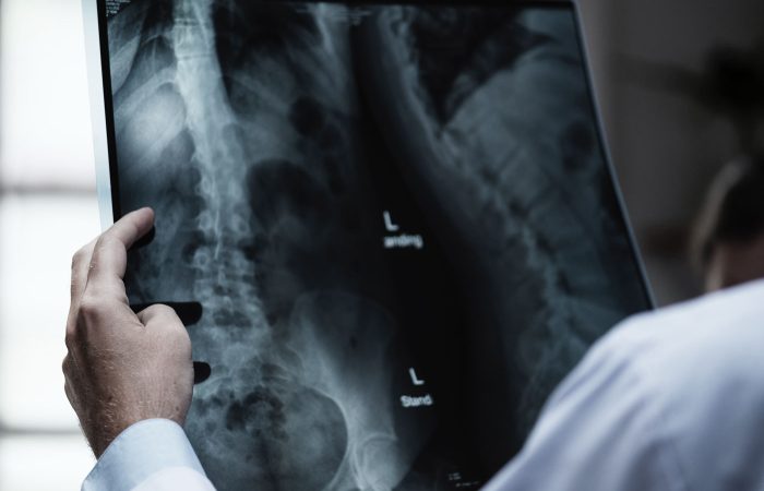 Making Sure the Closing Happens