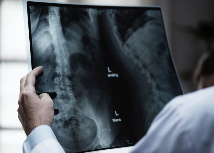 Making Sure the Closing Happens